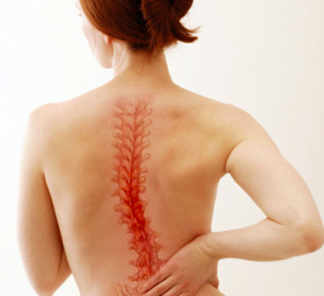 Scoliosis Treatment - Chicago Chiropractor