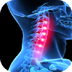 Whiplash and how a Chiropractor would Treat