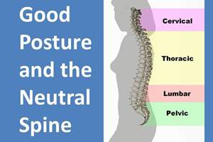 Chicago Chiropractic - Posture 